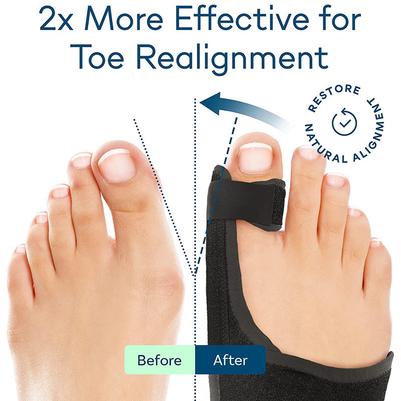 Big Toe Brace Hallux Valgus Orthotics Band